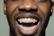 Gold And Diamond 6 Teeth Grills
