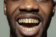 8 Teeth Perm Style Gold Grillz