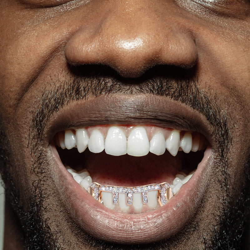 Gold And Diamond 6 Gold Teeth Grills