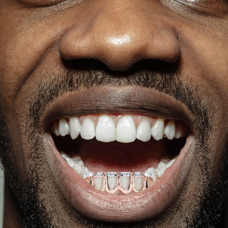 Gold 6 Teeth Two Tone Diamond Cut Grills