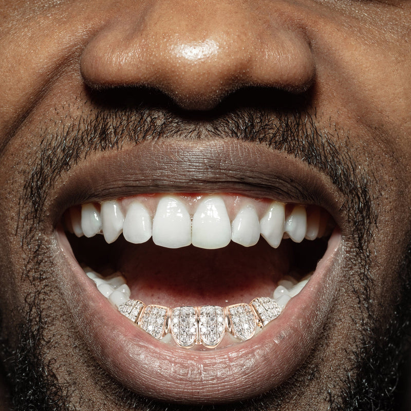 Gold 6 Teeth Full Diamond Grills
