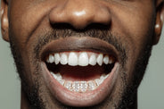 Gold 6 Teeth Full Diamond Grills