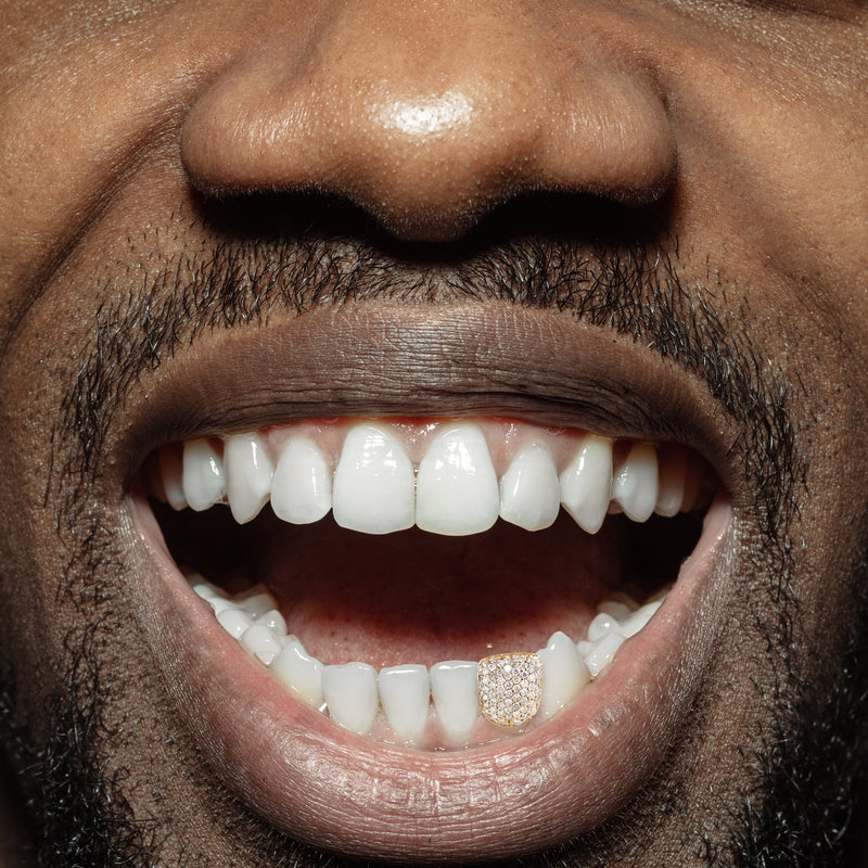 Gold And Diamond One Tooth Cap Grills