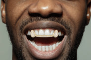Gold 6 Teeth Full Diamond Bar Grills