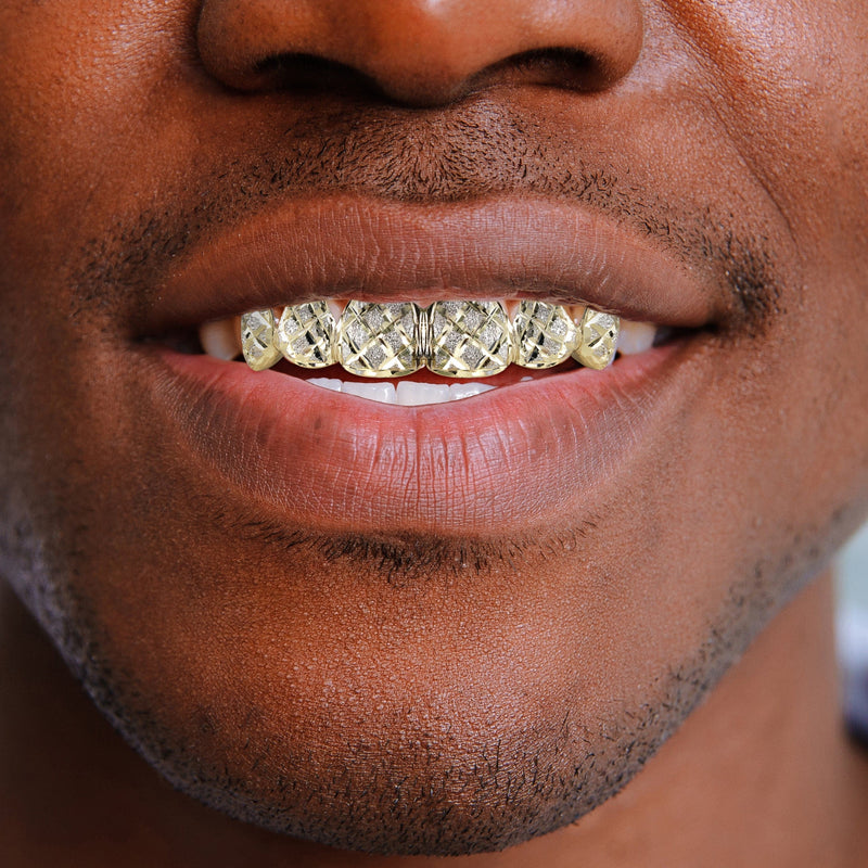 Gold 6 Teeth Diamond Dust Grillz