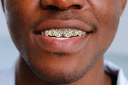 Gold 6 Teeth Diamond Dust Grillz