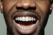 Gold 4 Teeth Custom Word Grillz