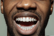 Gold 8 Teeth Diamond Drip Grills