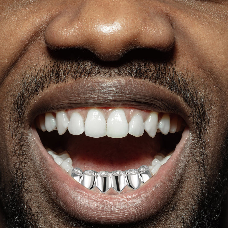 Gold 6 Teeth Diamond Grills