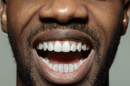 Full Diamond And Gold Honeycomb Setting 8 Teeth Grillz
