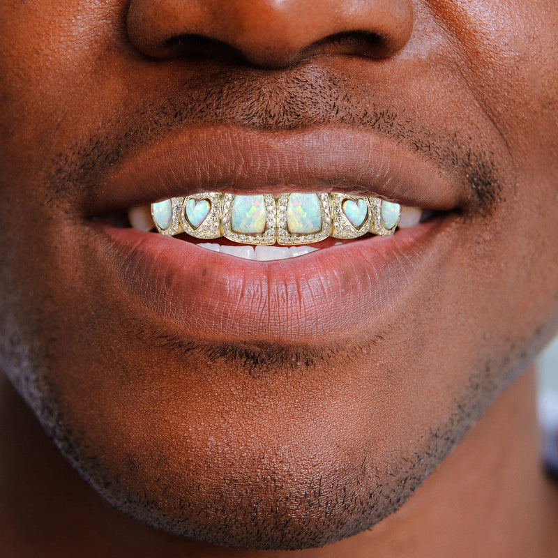 Gold 8 Teeth Diamond And Opal Grills