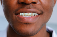 Gold 8 Teeth Diamond And Opal Grills