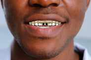 Gold 8 Teeth Gold Grills