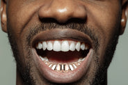Gold 10 Teeth Gold Grillz