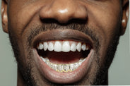 Gold 8 Tooth Invisible Set Princess Grills