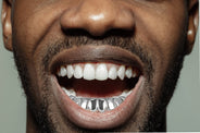Gold 8 Teeth Plain Grills